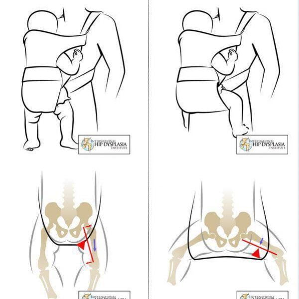 baby carrier positioning